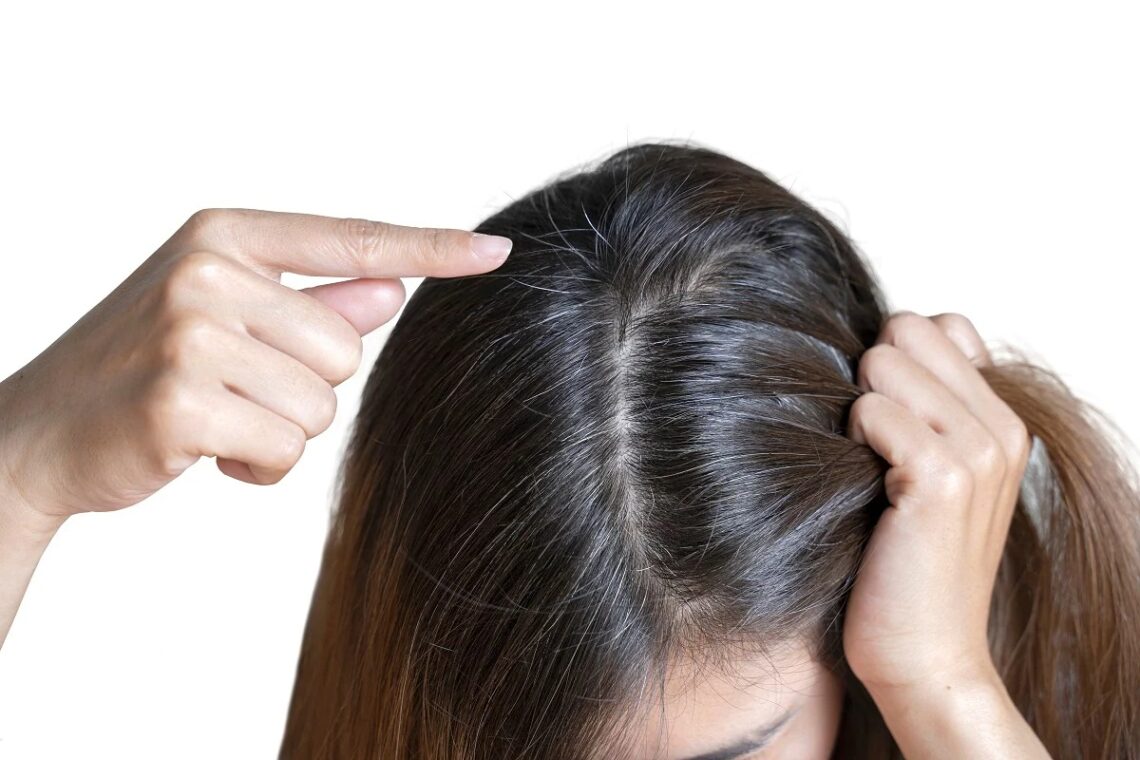 Jeune femme montre ses cheveux blancs